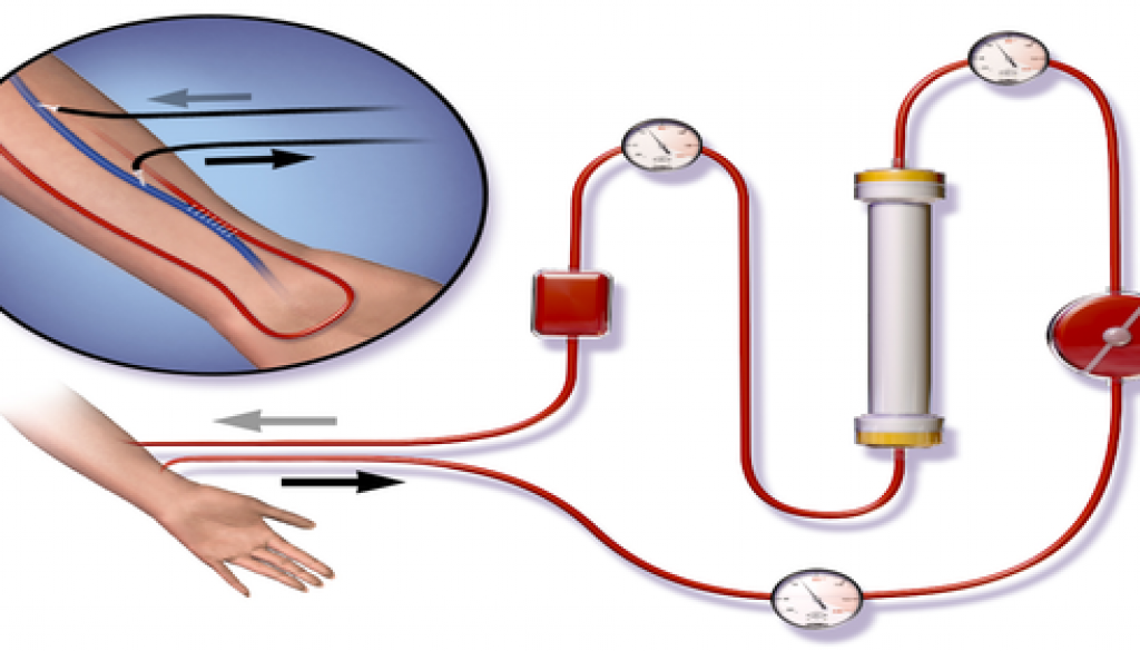 medical device, medical device manufacturing, tijuana manufacturing