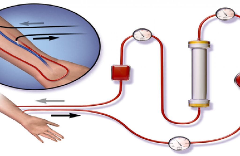 medical device, medical device manufacturing, tijuana manufacturing