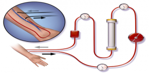 medical device, medical device manufacturing, tijuana manufacturing